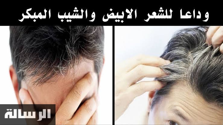 هتبقي احلي من احمد عز.. مكون في كل بيت يخلصك من الشعر الأبيض نهائيا بوصفه جبارة من اول استعمال هتبان النتيجه!!