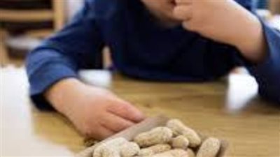 «دراسة سويدية :تكشف كيف يتم علاج حساسية الأطفال وسر الفول السوداني؟