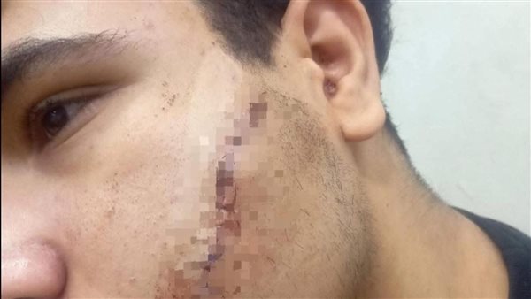 اعتداء طالب على زميله في شبرا الخيمة عقب مشادة كلامية