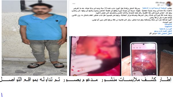 الداخلية توضح تفاصيل الاعتداء على شاب بواسطة آلة حادة في الدقهلية