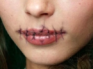 بإبرة وخيط.. يابانية تخيط شفتي جارتها لمنعها من الكلام! – أخبار السعودية