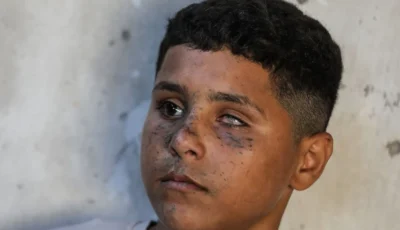عادل العشي.. طفل غزي فقد عينه وسمعه في قصف إسرائيلي وهو يلعب الكرة
