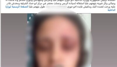 خلافات عائلية تنتهي بالضرب، ضبط المتهم بالاعتداء على زوجة شقيقه في الشرقية