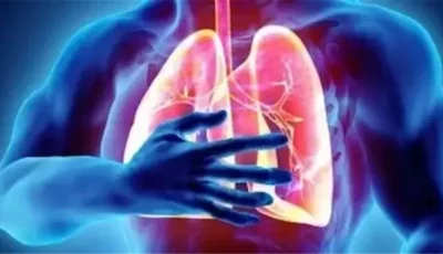 احذر، جلطة الرئة قد تبدأ من الساق