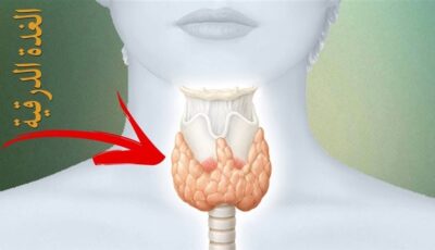 علامات لا يجب تجاهلها، أعراض الغدة الدرقية النشطة