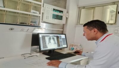 حصاد 13 شهرا، تقديم 2.3 مليون خدمة علاجية بمستشفيات الأمراض الصدرية