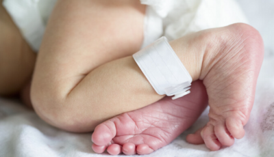 طفل يولد بـ4 أذرع و4 أرجل في الهند.. والأطباء يكشفون سر الحالة