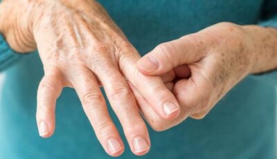 أعراض الروماتويد وأسباب الإصابة به وطرق العلاج