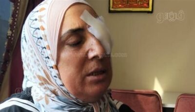 أقاربها استولوا على حقها في أرض المانجو، سيدة بالإسماعيلية تتعرض للضرب والسحل وتفقد عينها