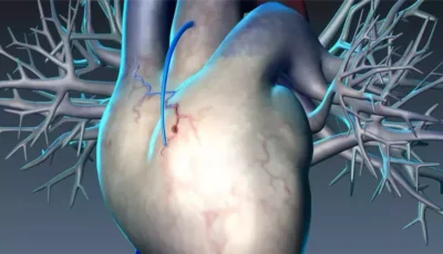 ليست نتيجة إرهاق.. 5 علامات تنذر بقرب حدوث جلطة قلبية