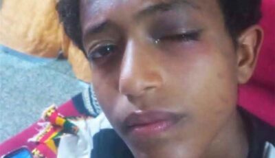 المشهد اليمني – طفل يُصلي وهو ينزف.. اعتداء مروع داخل مسجد بخورمكسر ووالده يكشف الكارثة