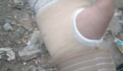 المشهد اليمني – بسبب رسالة «واتساب».. مدير مدرسة في تعز يكسر ذراع طالب بالسلك الكهربائي (تفاصيل مروعة)