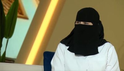 استشارية توضح الأعراض المرضية لصدفية المفاصل
